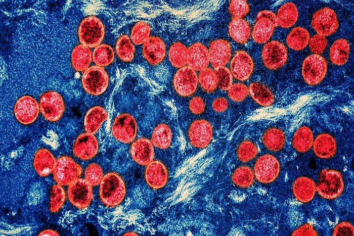 Colorized transmission electron micrograph of monkeypox virus particles (red) found within an infected cell (blue), cultured in the laboratory.